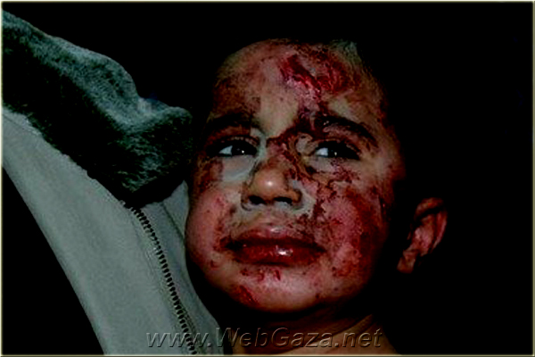 Children- 07 | Gaza Genocide Victims