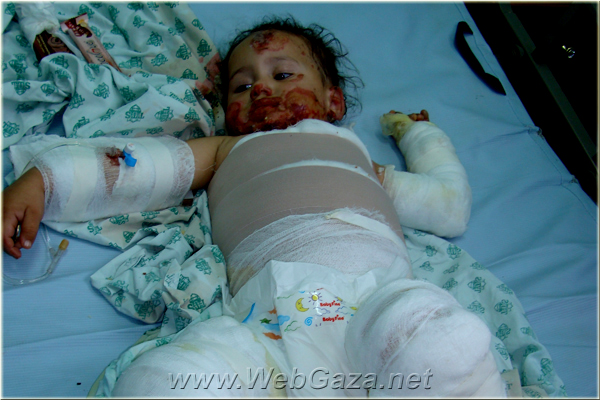 Children- 53 | Gaza Genocide Victims